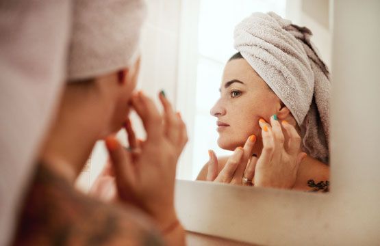 Conseils pour les peaux adultes à imperfections !