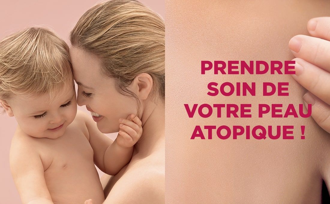 Prenez soin de votre peau atopique !